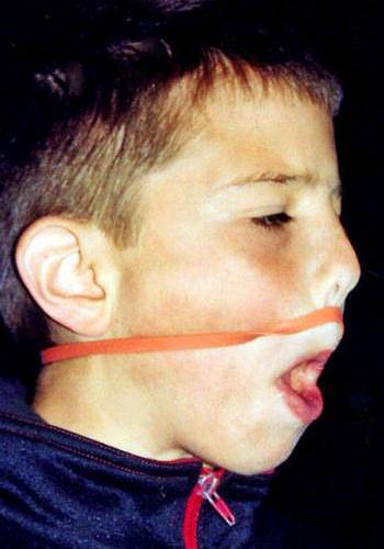 Rubber band from mouth to neck